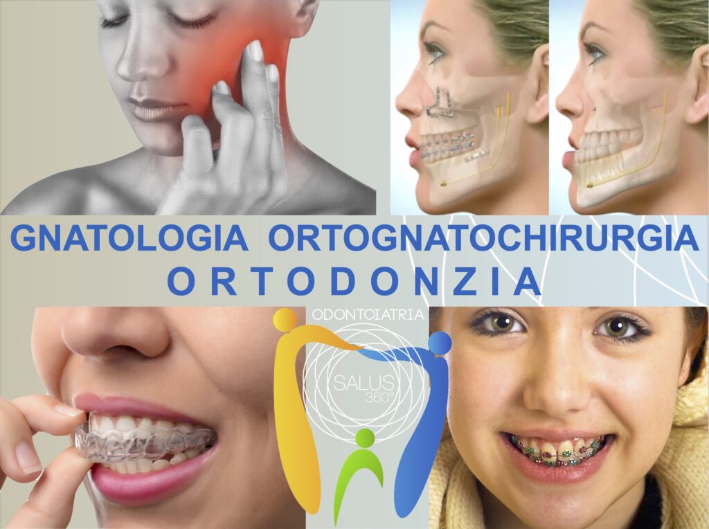 Salus360-ORTODONZIA-GNATOLOGIA-ORTOCHIRURGIA-torino